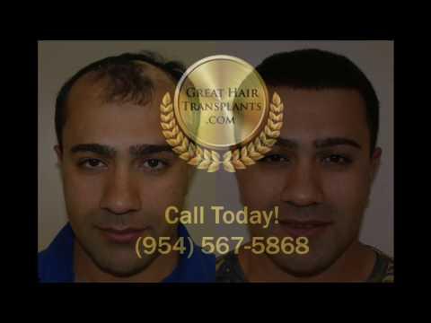 Hair Transplant Videos