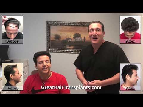 Hair Transplant Video