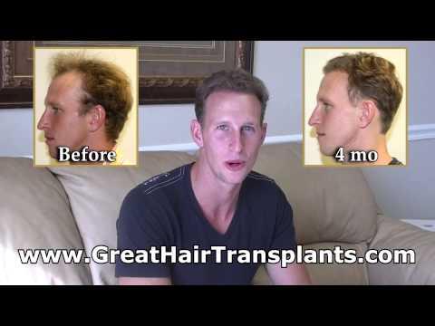 Hair Transplant Videos