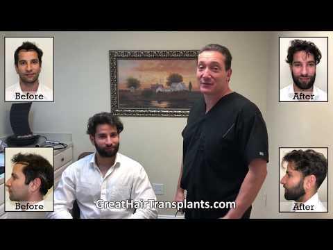 Hair Transplant Video