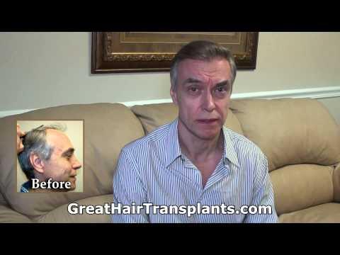 Hair Transplant Videos