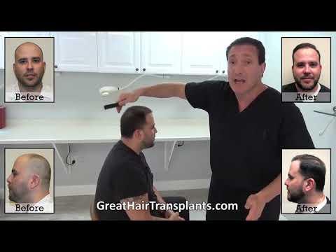 Hair Transplant Video