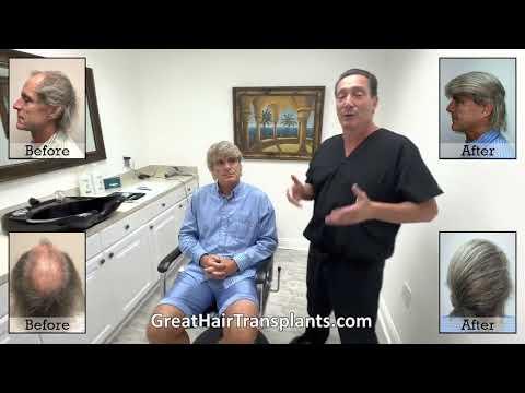 Hair Transplant Video