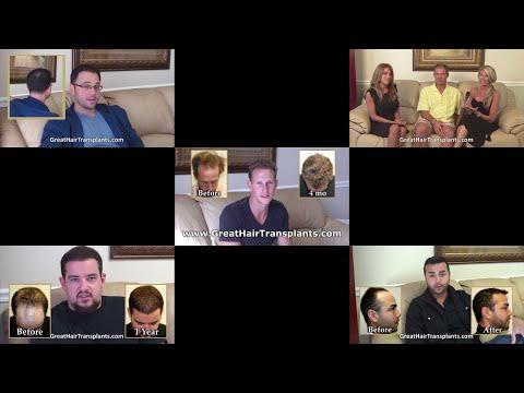 Hair Transplant Videos