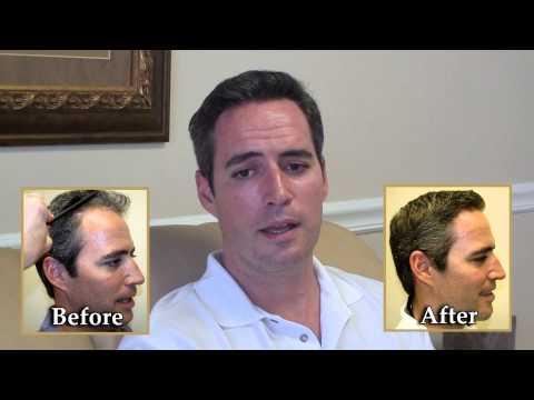 Hair Transplant Videos