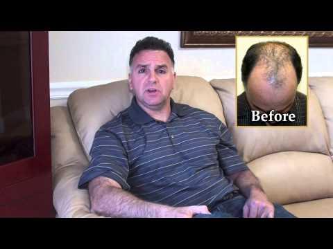 Hair Transplant Videos