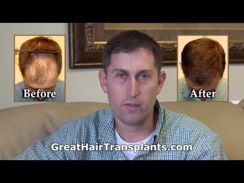 Hair Transplant Videos