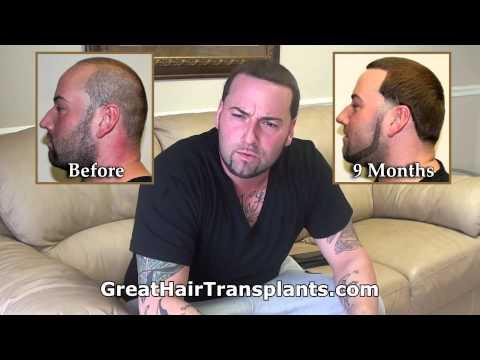 Hair Transplant Videos