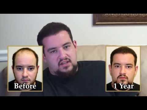 Hair Transplant Videos