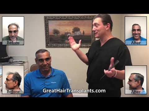 Hair Transplant Video