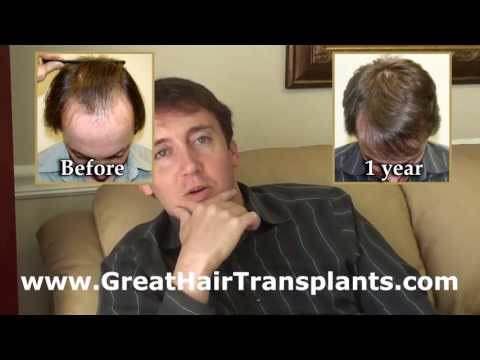 Hair Transplant Video