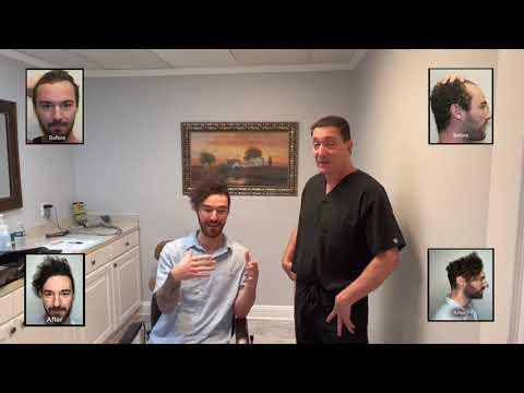 Hair Transplant Video