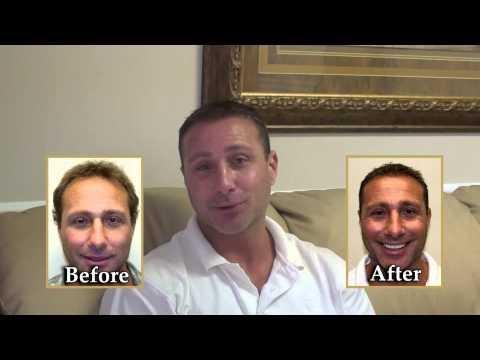 Hair Transplant Video