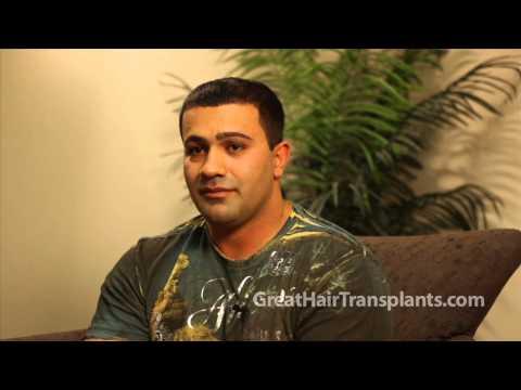 Hair Transplant Video