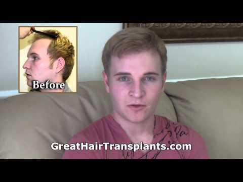 Hair Transplant Videos