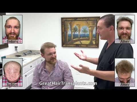 Hair Transplant Video