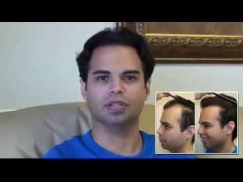 Hair Transplant Video