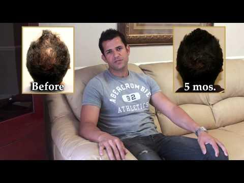 Hair Transplant Videos