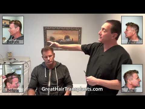 Hair Transplant Videos