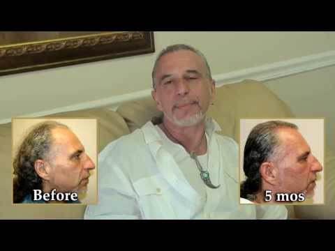 Hair Transplant Videos