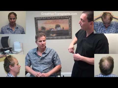 Hair Transplant Video