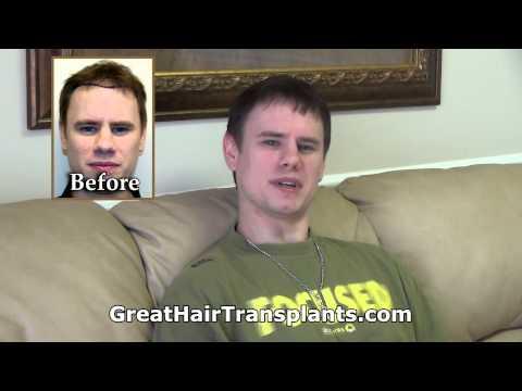 Hair Transplant Videos