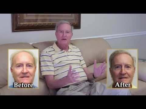 Hair Transplant Video