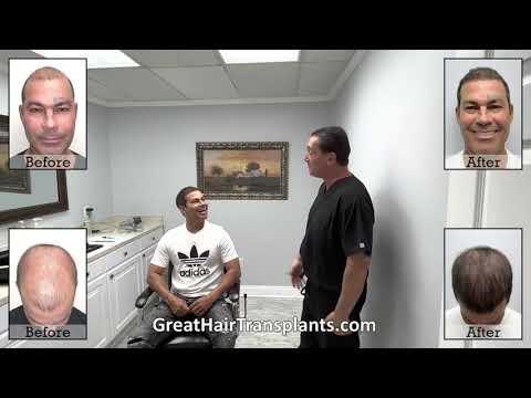 Hair Transplant Videos