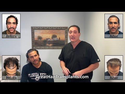 Hair Transplant Video