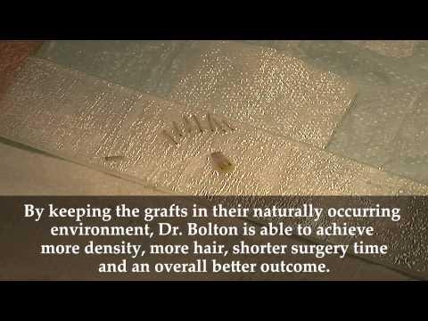 Hair Transplant Videos