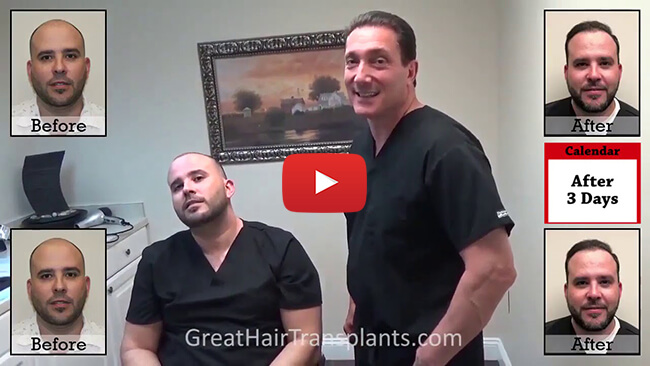 Hair Transplants Video in fort lauderdale , florida